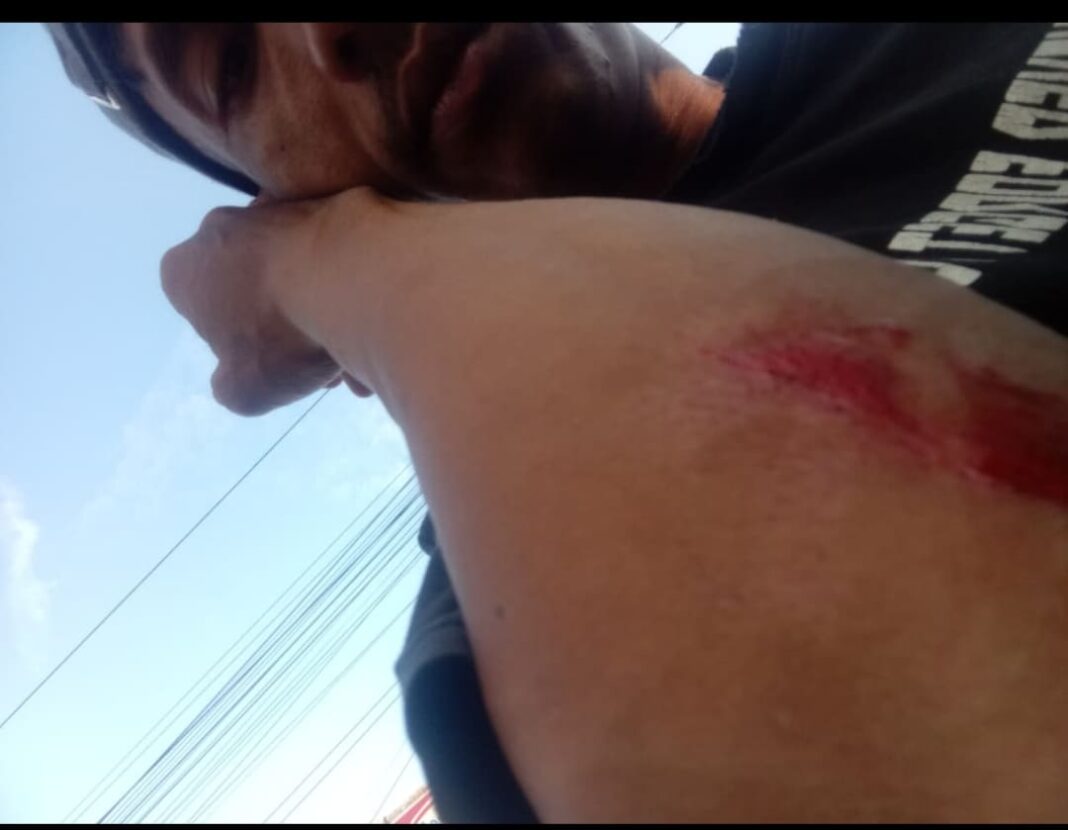 Kurir Paket Diduga Dianiaya Penerima Barang di Cikampek Barat